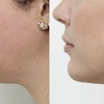 کلینیک زیبایی الماس کاملا اقساطی