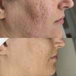 مرکز لیزر موهای زائد ماهور