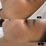 خدمات فیشال صورت و بدن طلوع