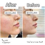 مرکز زیبایی,بوتاکس و لیزر آروشا