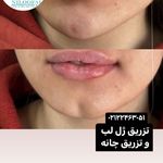 کلینیک پوست و مو و لیزر نیلوفر آبی