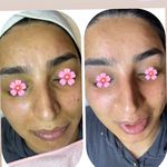 مرکز پاکسازی  و فیشال  تخصصی پوست سارا