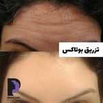 کلینیک زیبایی پوست و مو و لیزر پامچال