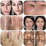 فیشیال و پاکسازی پوست تالگو فرانسه