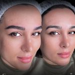 فیبروز و میکروبلیدینگ ابرو ستاره کریمی