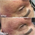 مرکز لیزر و پاکسازی پوست روژین