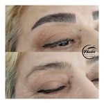 خدمات تخصصی ابرو حدیث معصومی