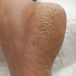 کفسابی و پدولوژی ناخن خانمها و آقایان