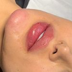 مطب زیبایی دکتر نلسا