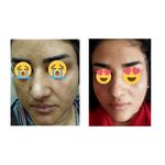 پاکسازی پوست وفیشال تخصصی فاطیما