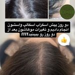 موسسه آموزش و درمان انواع ریزش مو ریشه