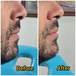 کلینیک زیبایی و لیزر مو  گندم