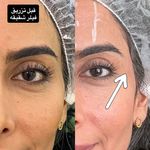 کلینیک زیبایی و لیزر دکتر آزاده اسماعیلی