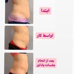 کلینیک تغذیه و رژیم درمانی و تناسب اندام (دکتر هانیه روانبخش)