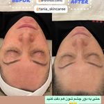 خدمات فیشیال و پاکسازی پوست