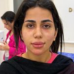 کلینیک تخصصی ژل و بوتاکس مرضیه آقابابایی