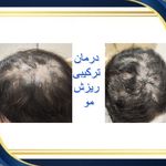 کلینیک پوست مو زیبایی هلیا