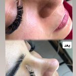 پاکسازی پوست محمودآباد - ریحانه