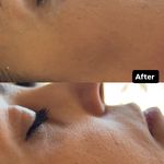 خدمات تخصصی پوست،فیشال،ماساژ سندی بانوان