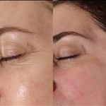 کلینیک تخصصی پوست ملینا