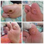 کارشناس زخم و متخصص کیوم تراپی بهرامی فر