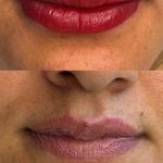 میکروکیماسی( میکروابرو چشم لب،ریمو)