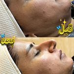 فیشال تخصصی  سعیده صدیقی