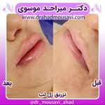 دکترمیراحدموسوی