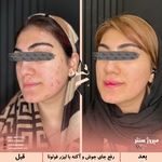مرکز پزشکی و زیبایی میروژ سنتر