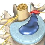 کلینیک پیشرفته درد دکتر امیرعلوی