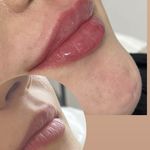 مرکز لیزر ،پوست و زیبایی کندی بیوتی