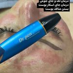 خدمات پوست ومو و لیزر موهای زائد