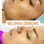 پاکسازی پوست الهه دوستی