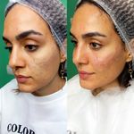 کلینیک زیبایی پارسیان آلفا