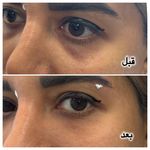کلینیک زیبایی و لیزر باران در شهرری