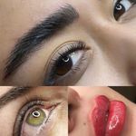 هدا ایزدی ؛ میکرو تخصصی صورت اصفهان