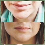 مطب تخصصی زیبایی و لاغری آنجل