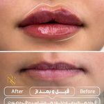 کلینیک زیبایی نورارُز پردیس