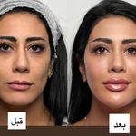 کلینیک پوست وزیبایی ومرکز تخصصی فیلربادی