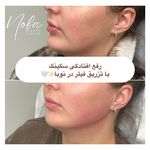 کلینیک زیبایی و لیزر مو زائد نوبا