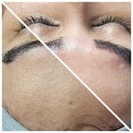 مراقبت های پوستی و فیشال آرا اسکین