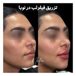 کلینیک زیبایی و لیزر مو زائد نوبا
