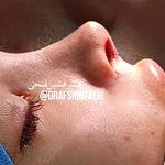 فوق تخصص جراحی زیبایی و بینی دکتر فتحی