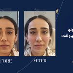 کلینیک زیبایی آرا مهر