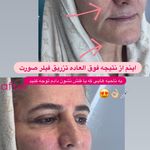 مرکز لیزر و کلینیک زیبایی پریفا