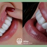 کلینیک دندانپزشکی آتیسا
