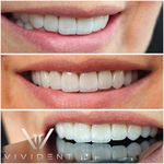 مطب دندانپزشکی دکتر فاطمه محمودی افصح