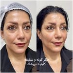 کلینیک تخصصی لیزر ،پوست و‌زیبایی بهشاد