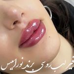 کلینیک پوست و مو و لیزر نیلوفر آبی