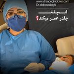 کلینیک دندانپزشکی،ایمپلنت دکترالهه صادقی